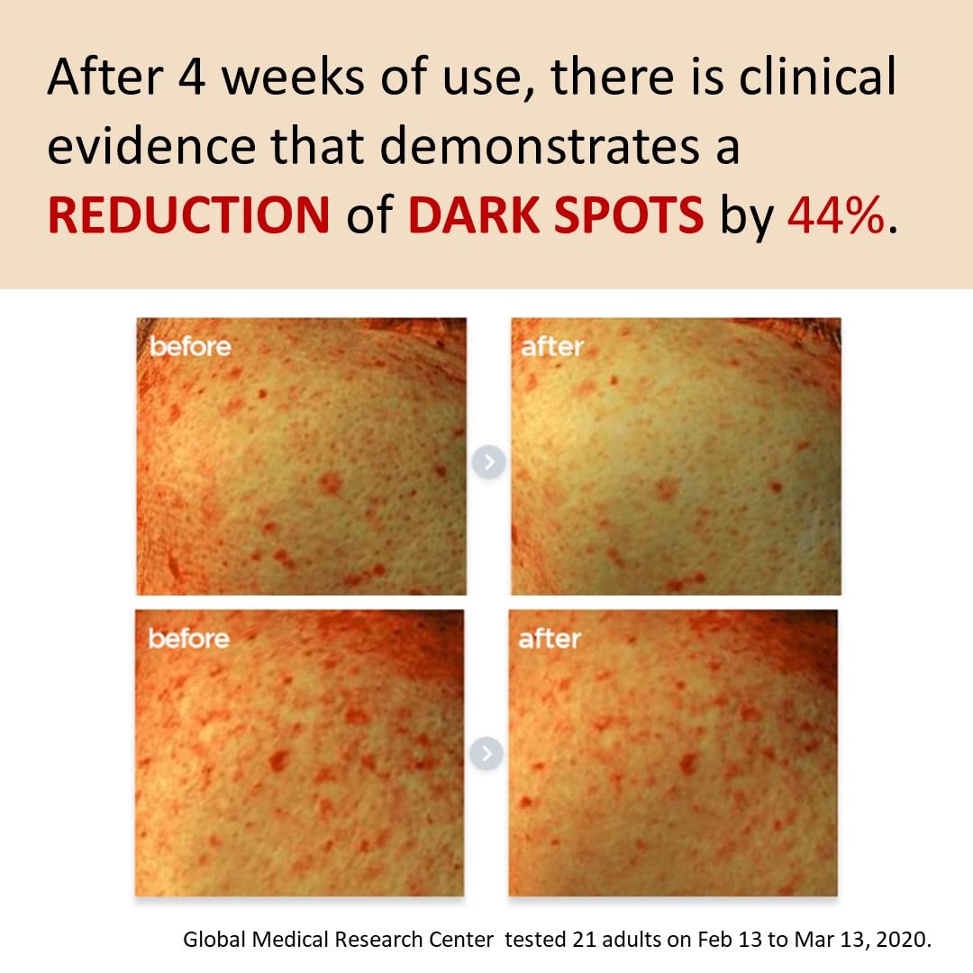 [Make p:rem] Poncirus trifoliata C Dark spot serum | Skin clearing serum | Uneven Skin Tone Treatment | Vitamin serum C face | 40ml, 1.35 fl.oz. | Make P:REM