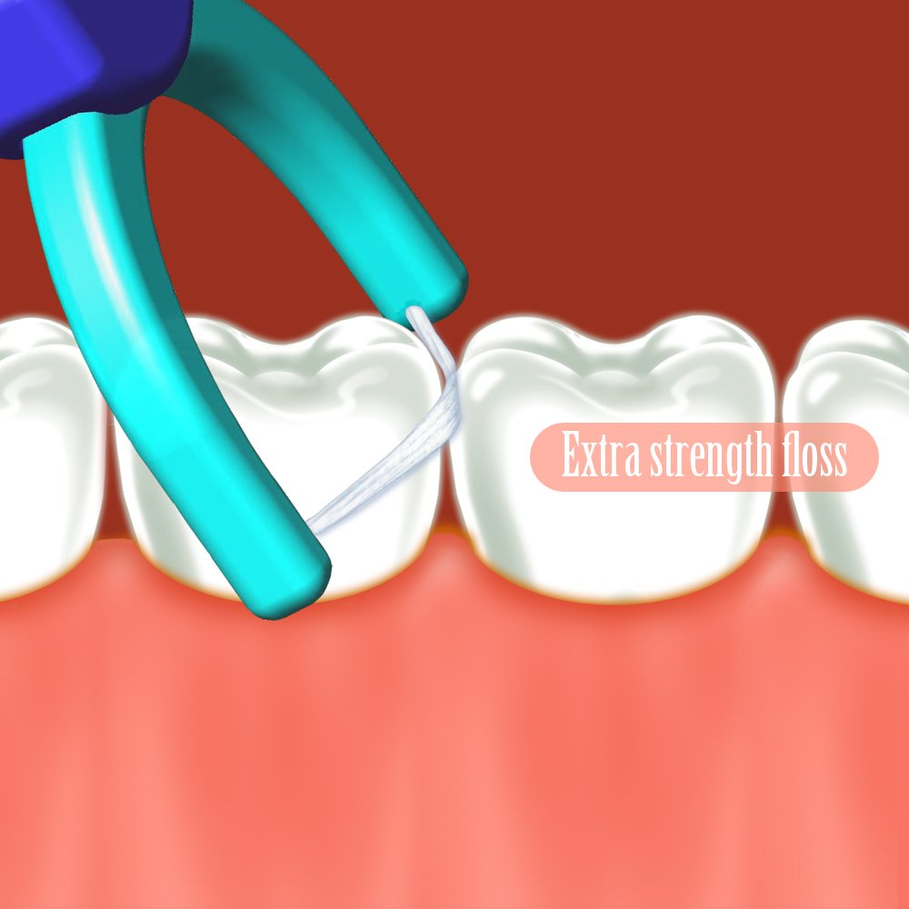 T.Smile NoFuss Dental Flosser Kit, 5-inch Long Handle & Refill Heads, Extra-Strength Floss for Comfortable Clean, Fluoride Free, (2 Handles + 200 Extra-Strength Floss Refills)