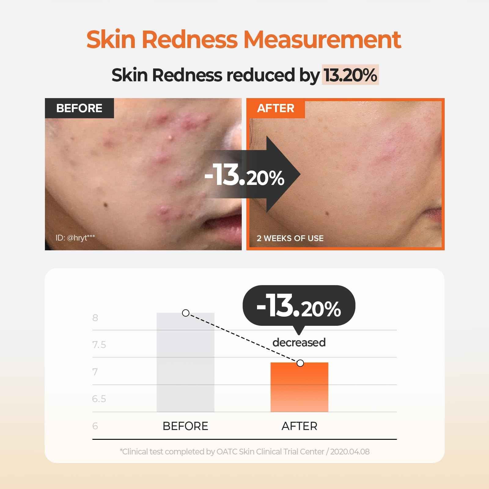 SKINFOOD Carrot Carotene Calming Water Toner Pads, Korean Skin Care Toner Pad for Face, Deep Hydrating, Soothing, After Sun Skincare for Sensitive Skin, Redness Relief, 100% Cotton, 8.81 oz (60 Pads)