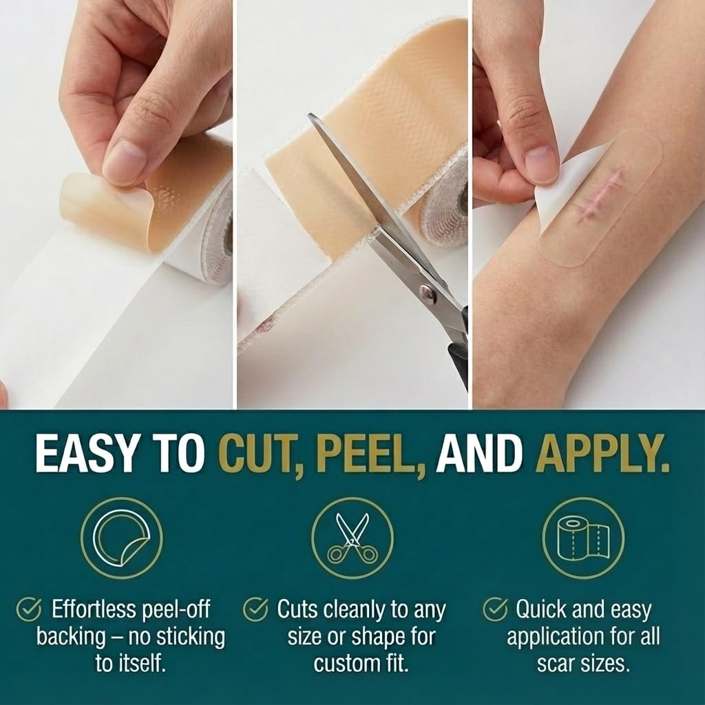 Silicone Scar Sheets, Silicone Scar Tape For Surgical Scars - Clinically Validated Technology Scar Treatment Strips For Hypertrophic, C-Section, Tummy Tuck, Keloid Scars - Reusable, Waterproof