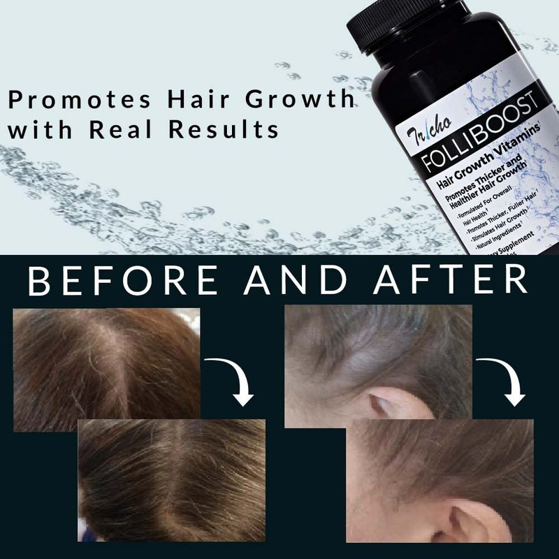 Folliboost Tricho Hair Growth Vitamins - Biotin, Vitamin C, Zinc & Vitamin B12 - Hair Care Capsules for Thicker, Fuller & Healthier Hair - 1 Pack