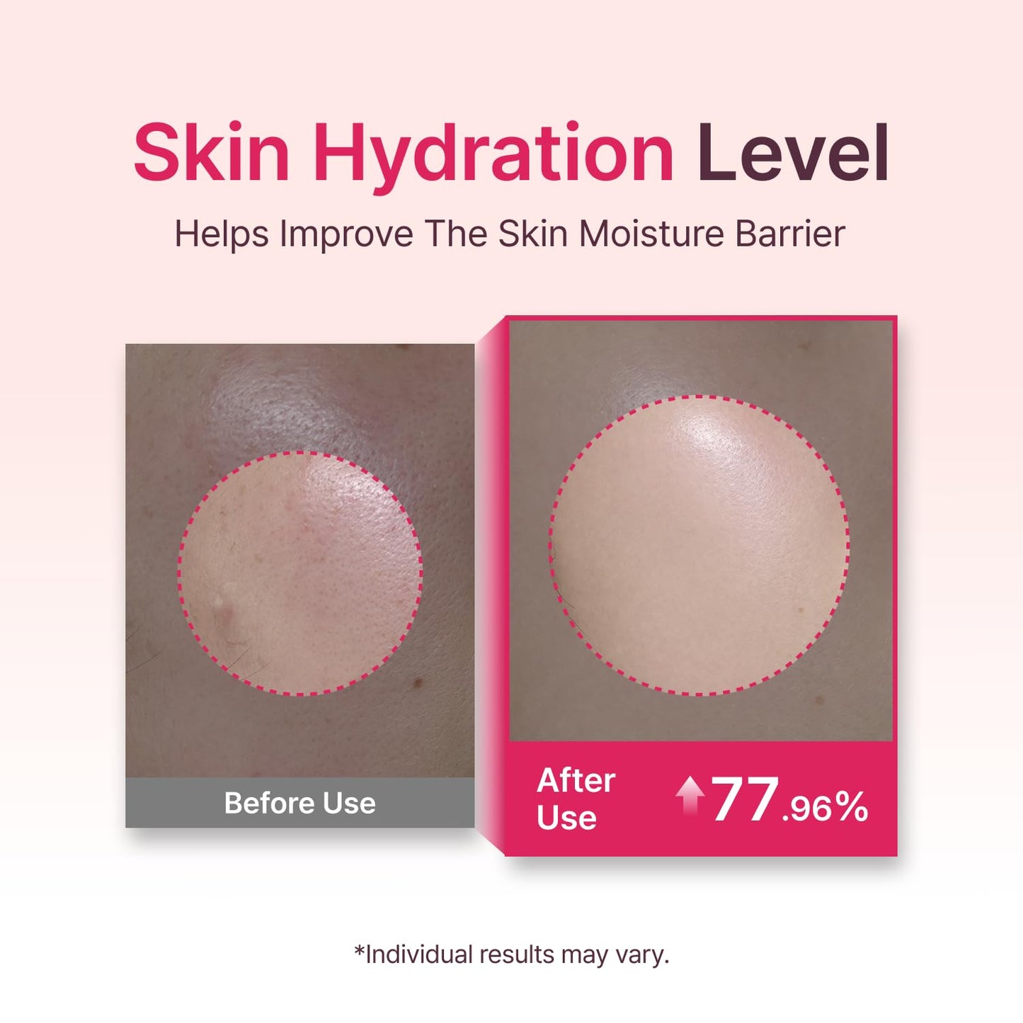 SECRETKEY Starting Rose Essence Toner, Galactomyces Ferment with Rose Water for Radiance Glass Skin, Hydrating Essence, Helps Improve Uneven Skin Tone, Korean Skin Care Essence (5.07 Fl Oz / 150ml)