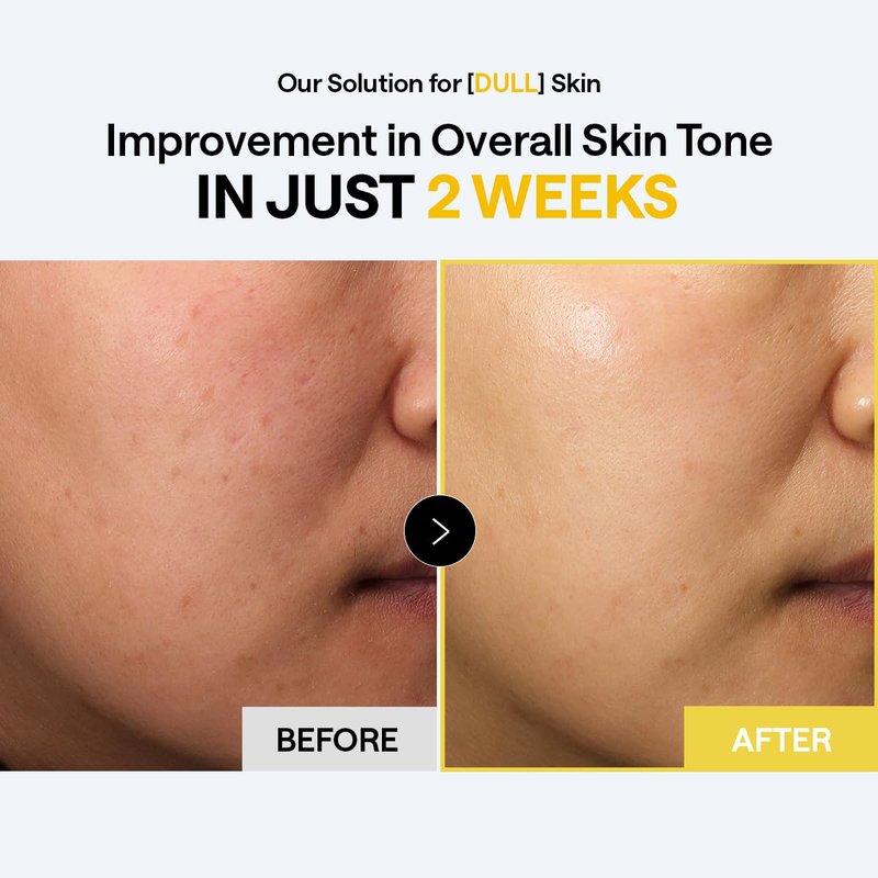 MEDIHEAL Toner Pads 100 Count - Vitamin C Skin Toning - Radiance Booster for Clear & Illuminating Skin - Contains Niacinamide for Blemish Care - Vegan Stretchable Fabric Pads, Korean Skin Care