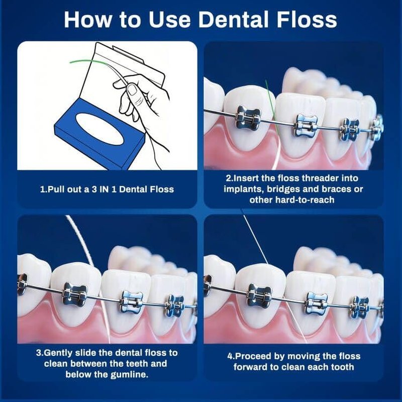 3-in-1 Dental Floss for Braces, Bridges & Crowns - 160 Pre-Cut Strands with Spongy Floss for Orthodontic Care