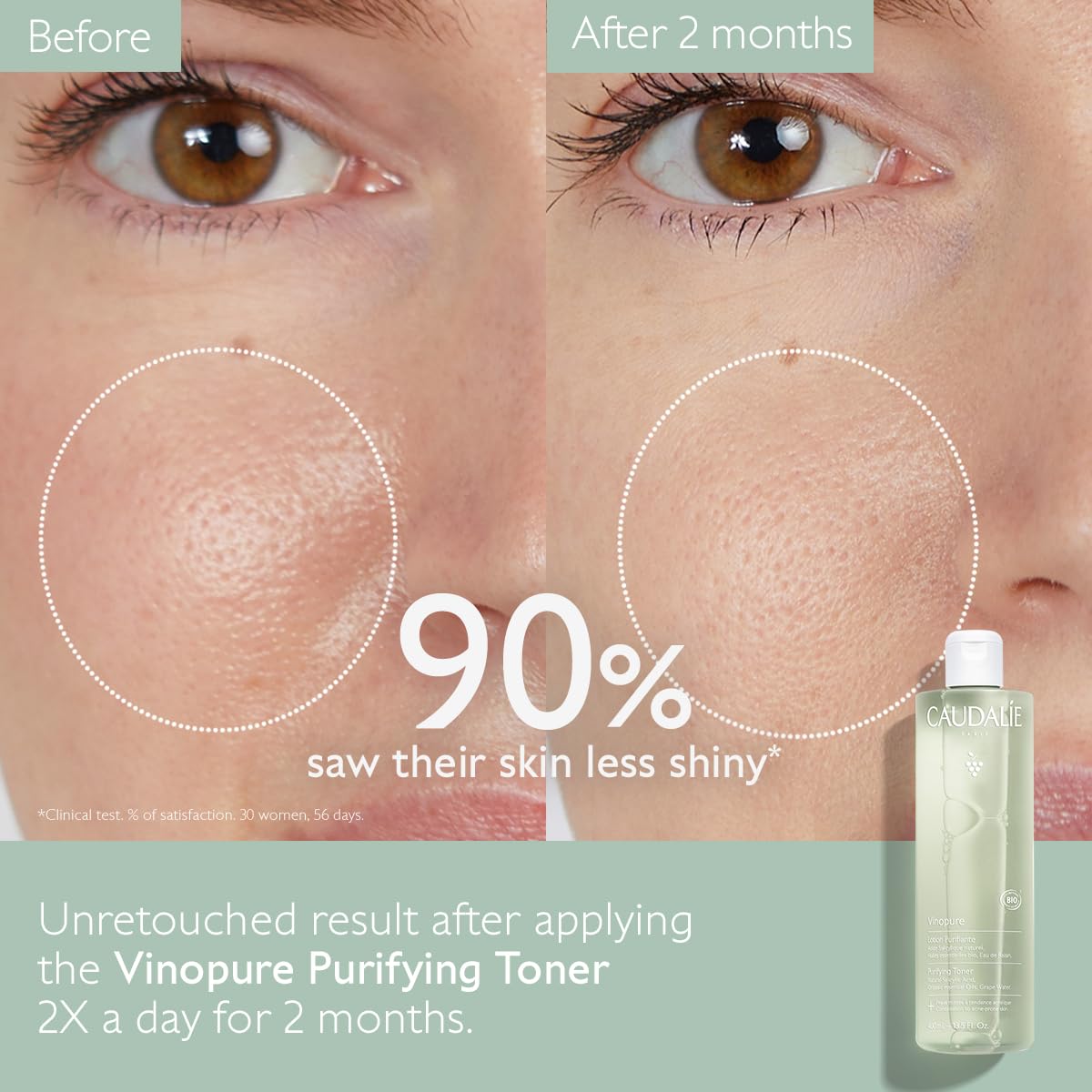 Caudalie Vinopure Natural Salicylic Acid Pore Minimizing Toner, 6.7 Ounce