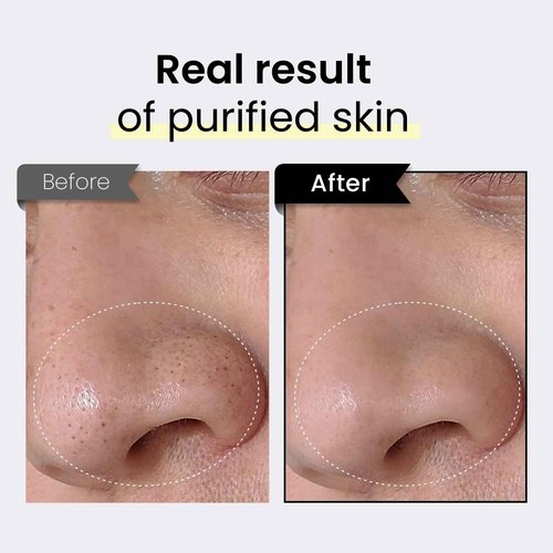 Coxir TXA Black Rice Pore Mask – Korean 3-in-1 Wash-Off Mask Serum with Tranexamic Acid | Pore Purifying, Blackhead Care, Skin Toning | Hydrating Mask Treatment [50ml/1.69 fl.oz]