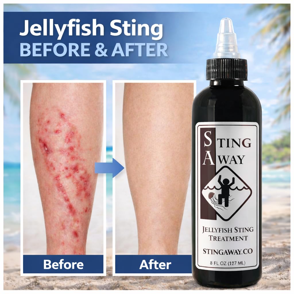 Sting Away - Jellyfish Sting Treatment (8 Ounce)
