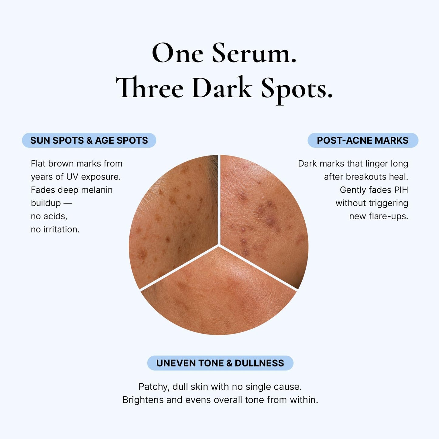 EnaSkin Dark Spot Corrector for Face & Body - 5% Tranexamic Acid, Niacinamide & Acid-Free Renewal Peptide - Hyperpigmentation, Melasma & Sun Spot Treatment, Gentle for Sensitive Skin, 1.01 fl oz