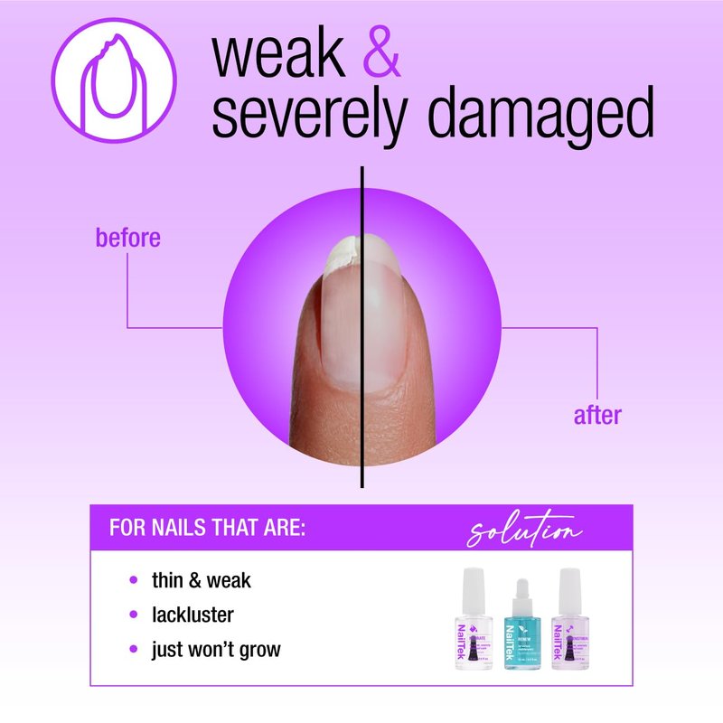Nail Tek Rescue System – Nail Repair for Damaged Nails, Hydrate, Renew & Strengthen Nails Treatment, Made in Usa, 0.5 Fl Oz Each