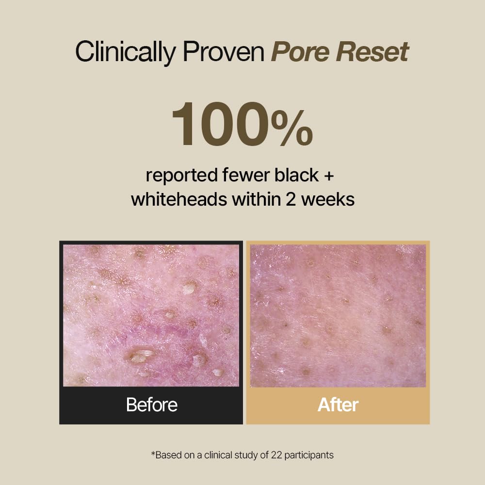 NATURAL DERMA PROJECT phytomucin foam face wash