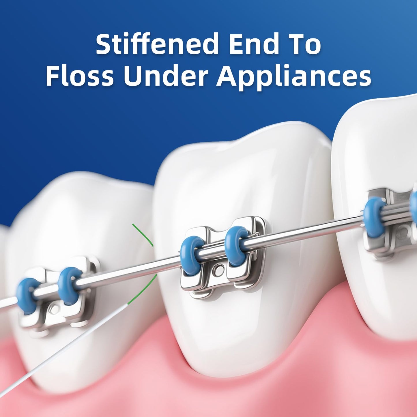 RioRand 3-in-1 Orthodontic Floss Threaders for Braces, Bridges & Implants - Pre-Cut Strands with Stiffened End & Spongy Expanding Floss, PFAS-Free 160 Count (Pack of 2)