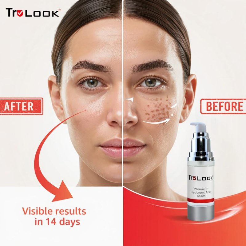 TruLook Vitamin C + hyaluronic Acid Serum for face, Anti Aging, Anti Wrinkle, Improves Dark Spots, Tone, & Fine Lines Made in USA