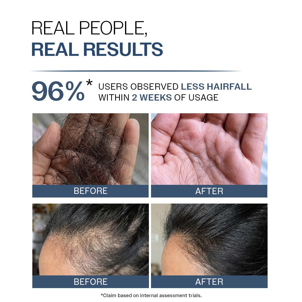 Anti-Hair Fall Shampoo - 5X Control with Adenosine & Peptides | Strengthens Roots | pH 4.6 | 250ml