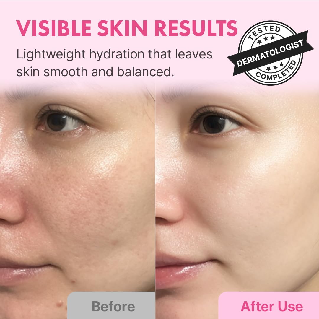 Hanskin Hyaluron Skin Essence Toner – Korean Hydrating Toner for Glass Skin | Hyaluronic Acid & Collagen | Lightweight Moisturizing Astringent for Dry, Sensitive & Dull Skin | K-Beauty (5.07 fl oz)