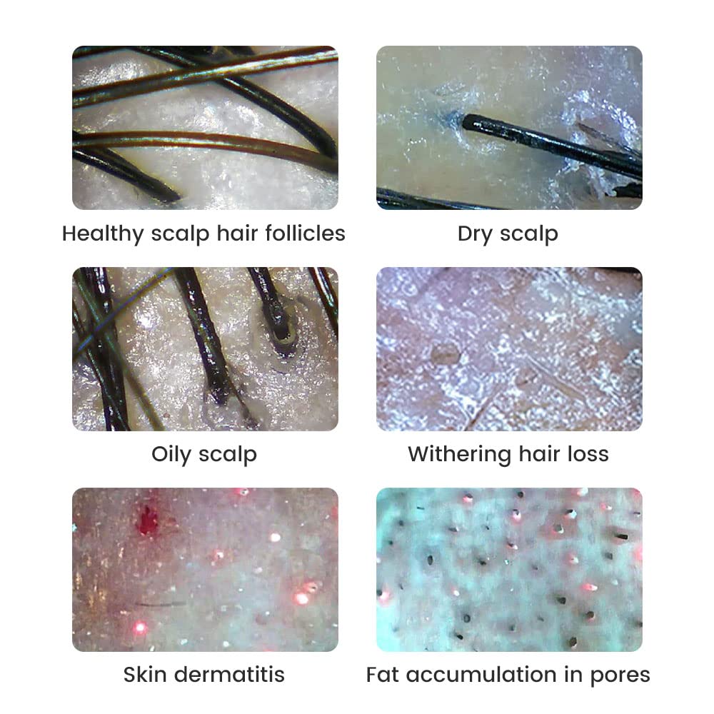 JBMBHC Handheld Dermatoscope Skin Analyzer Machine, Wireless Portable Digital Microscope with 1080P IPS Screen 8 LEDs, 500X Magnifier, for Scalp/Hair Trichomes Facial Skin Dermatoscope