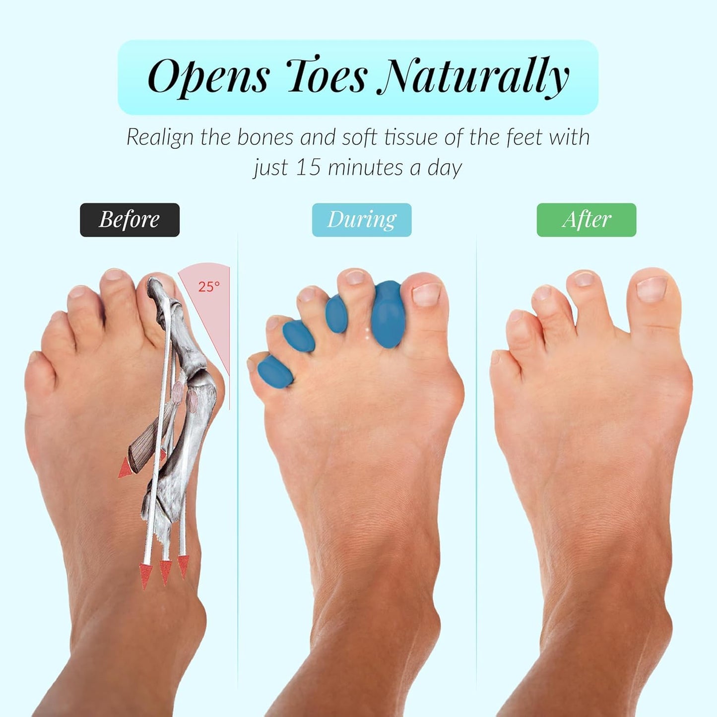 Toe Separators for Yoga & Foot Recovery - Soft Gel Spacers | Small Blue, 1 Pair, Reusable & Washable