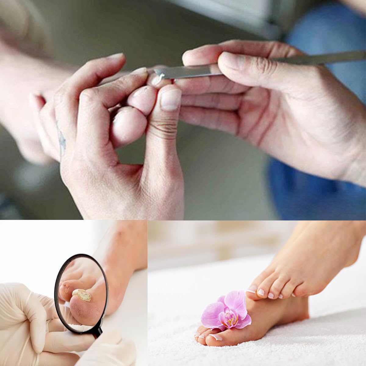 Exfoliating Ingrown Toenail Removal Pedicure Knife,Decorative Foot Knives for Ingrown Callus Shaver Feet Nail Correction Pliers Scissors Corn Remover With Storage Bag (3)