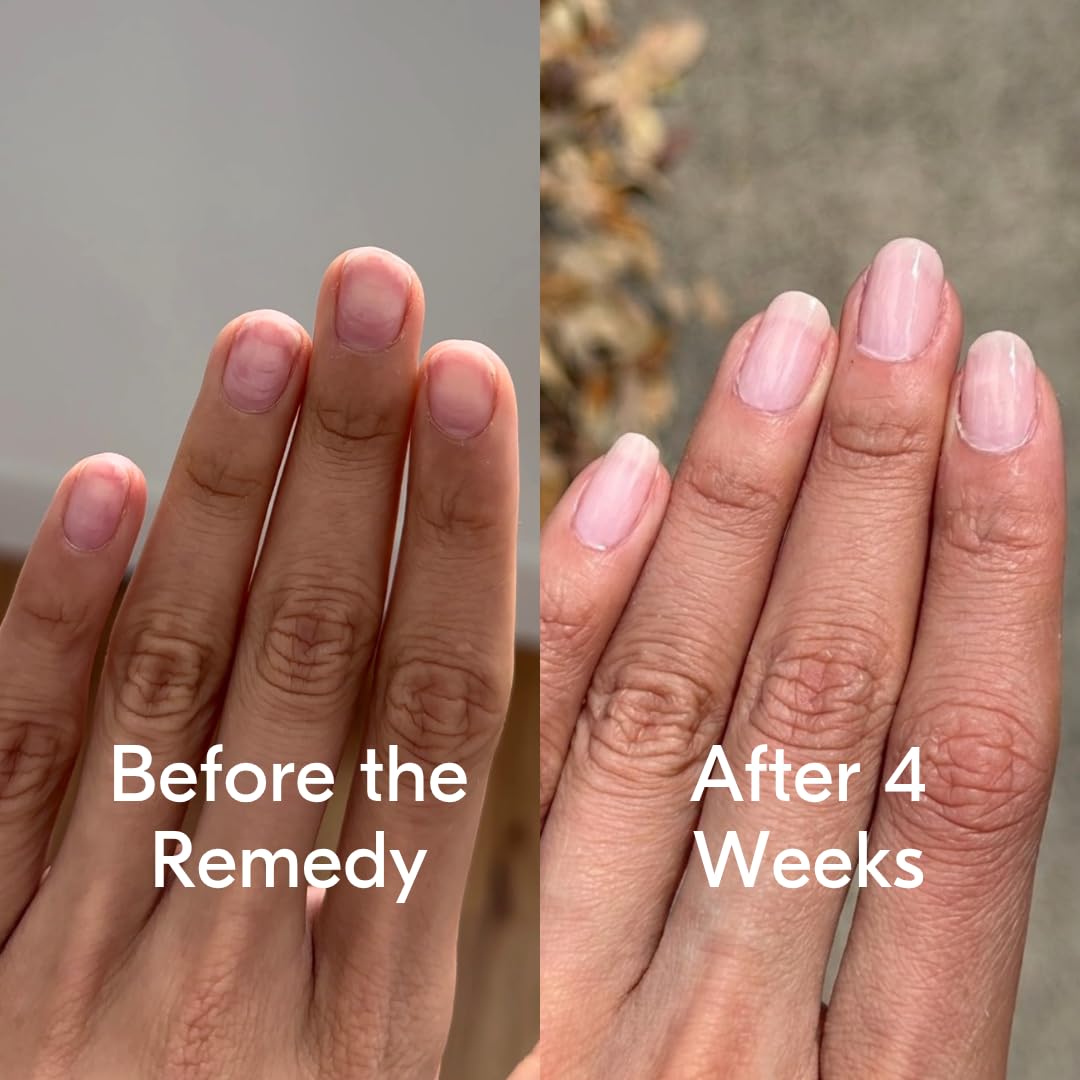 Botanist The Remedy Nail Strengthening Polish - Non-Toxic, Vegan Formula for Damaged Nails | 84% Plant-Based (Nude)