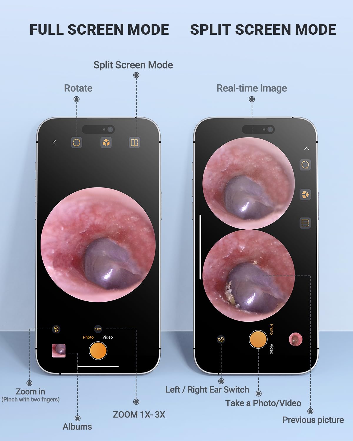 AnyScope HD Digital Otoscope, Video Ear Scope Otoscope with Light, Ultra Clear View Ear Camera with Ear Wax Removal Tools, Compatible with iPhone and Android Devices (Silver) ﻿