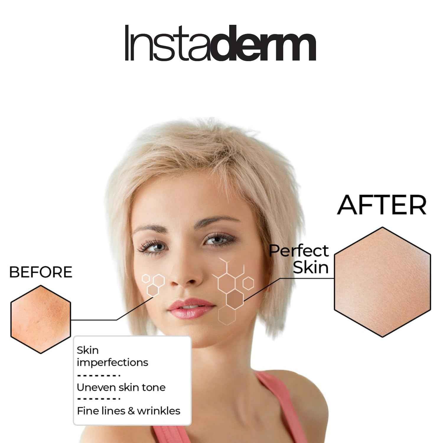 Complexion Renewal Pads – Exfoliates skin, Reduces Appearance of Uneven Skin Tone, Freckles, Fine Lines & Wrinkles. Restore Elasticity & Deep Hydration for Smoother Skin & Radiant Complexion.