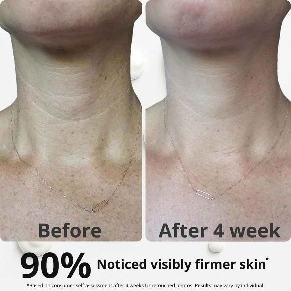 Neck Tightening Cream with Argireline AH-8, Bakuchiol, Hyaluronic Acid & Alpha Arbutin – Firming Moisturizer for Face, Neck & Décolleté – Anti-Wrinkle Cream for Women & Men – 1.76 Oz