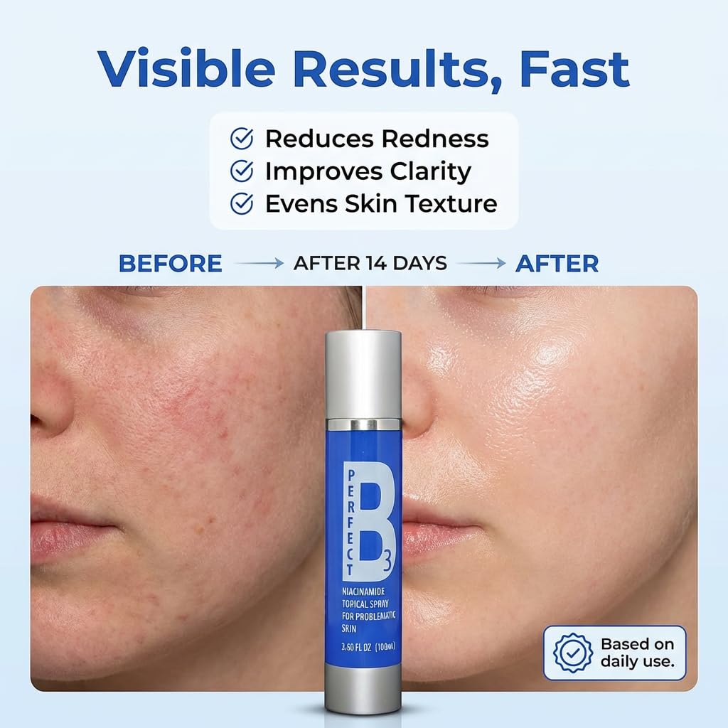 Perfect B3 Niacinamide Spray for Face 6 in 1 - Vitamin B3 Niacinamide Face Mist Skin Care Serum, Hyaluronic Acid, Aloe & Glycerin - Skin Brightening Face Spray - 3.6 Fl Oz