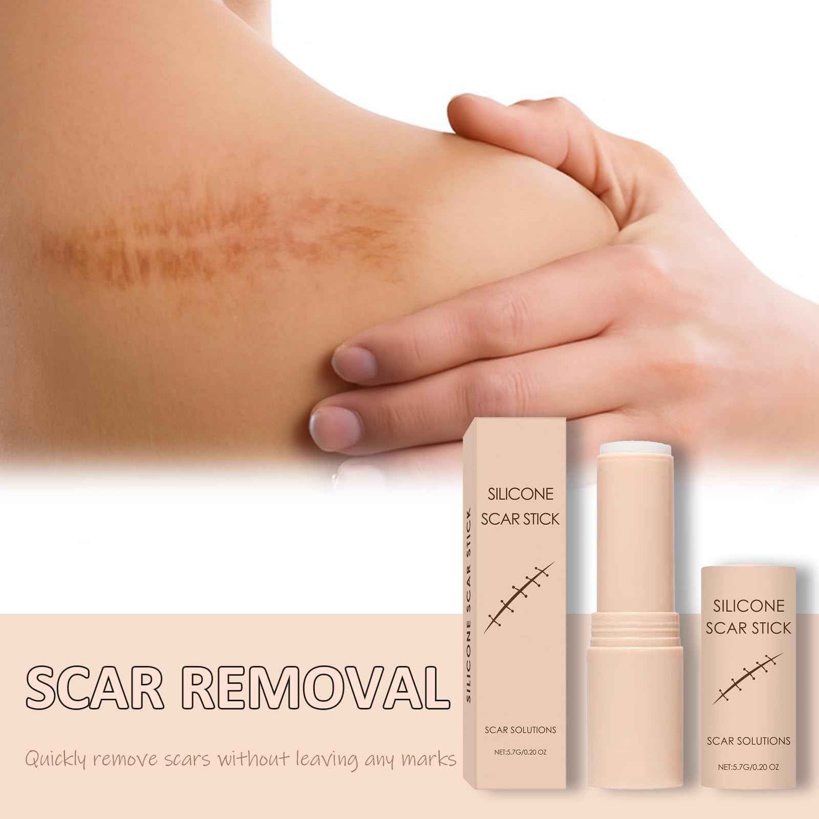 Silicone Scar Stick (2-Pack) - Helps Improve the Appearance of Old & New Scars on Face & Body, For Use After C-Section, Surgery, Acne, Burns - Non-Greasy, Easy-to-Use