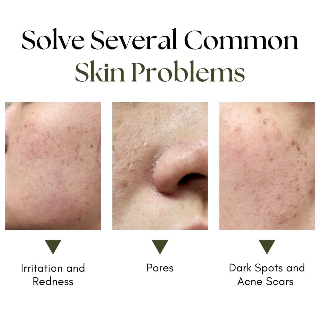 10x Antioxidant Serum for Face | Hyaluronic Acid, Niacinamide, Green Tea, Aloe Vera, and More | Hydrating Lightweight Nourishing Sap