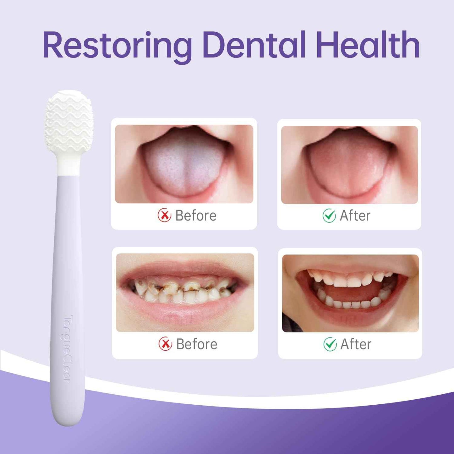 Tongueclear Kids Tongue Scraper, Tongue Cleaner for Infant & Newborn, Baby Oral Cleaner Newborn, Toddler Toothbrush for Tooth Mouth Gum Clean, Infant Toothbrush Oral Cleaning Stick…