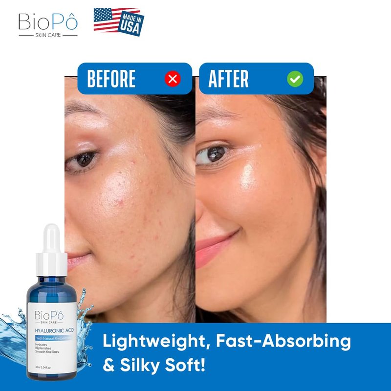 Hyaluronic Acid Serum 30 ml - Hydrating and Anti-Aging, Smooths Fine Lines, Replenishes Skin, Pure Hyaluronic Acid for Face & Skin - Suitable All Skin Types - Made in USA