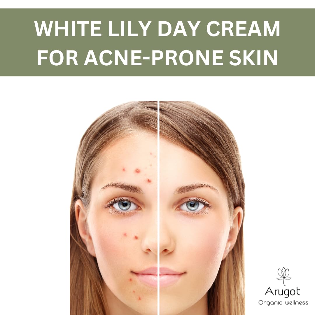 Arugot White Lily Organic Verbena Lightweight Day Cream for Acne & Pimple Prone Skin, Skin Clearing Moisturizer for Face & Neck, Made in Israel, 1.7 ounces