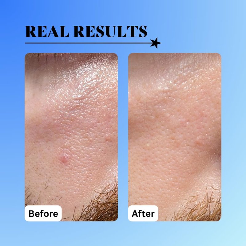 10% Glycolic Treatment Tonic Exfoliating Toner for Face and Body, Alcohol Free, Combats Acne and Hyperpigmentation, Rough Skin, All Skin Types Including Sensitive