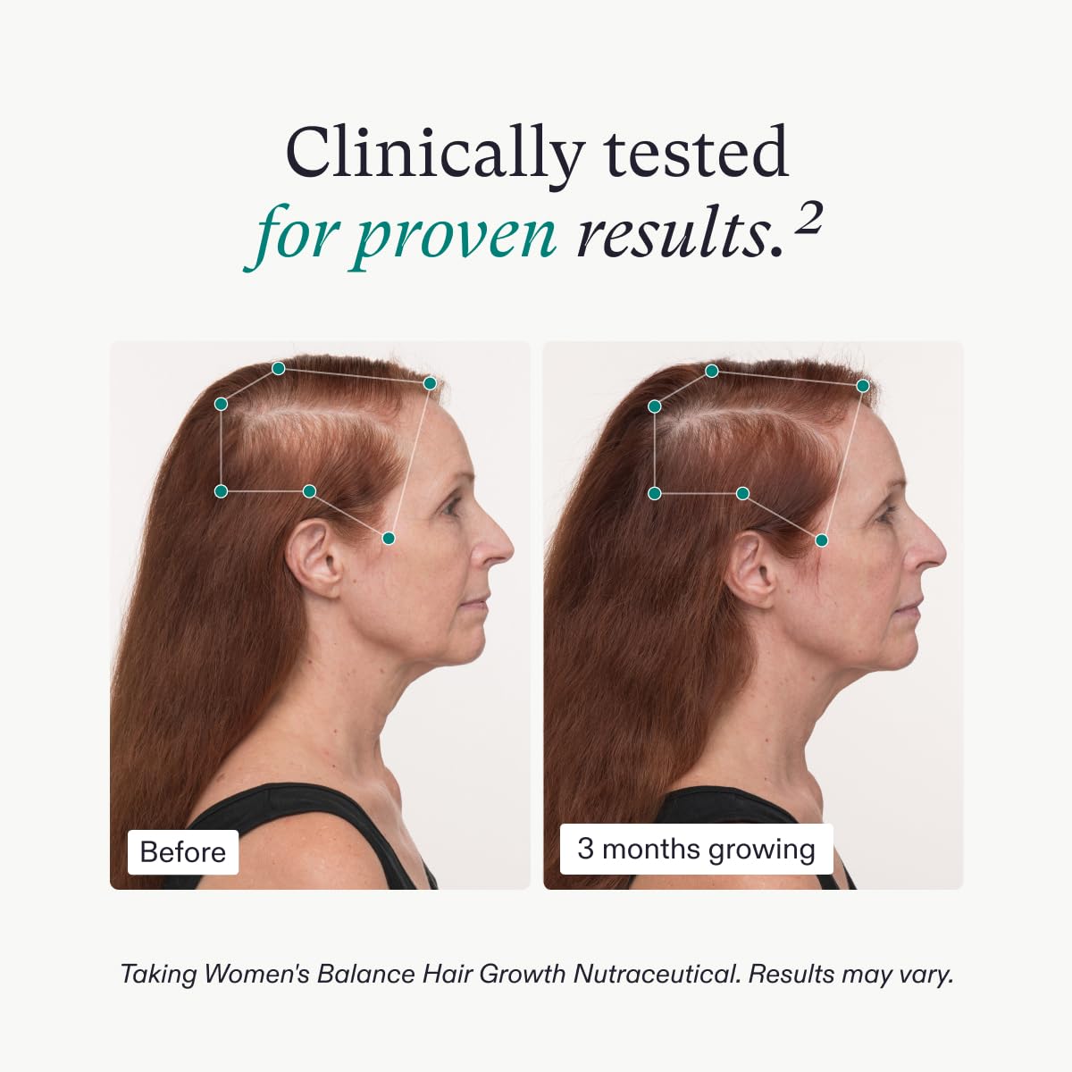 Nutrafol Women's Balance Hair Growth Supplement with Collagen Peptides, Ages 45+, Clinically Tested for Stronger, Visibly Thicker Hair, Dermatologist Recommended - 1 Month Supply, 12 oz Bottle