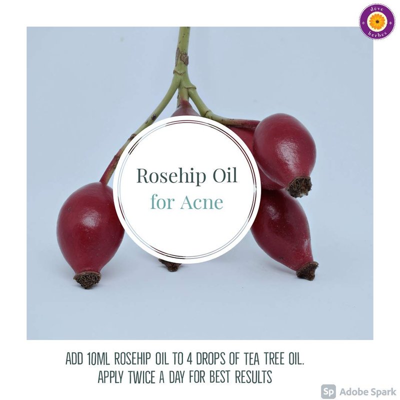 dève herbes Rosehip Oil (Rosa rubiginosa) | Cold Pressed | Pure | Natural | Undiluted | For Diluting Essential oils | For Skin & Massage | Non-Sticky| Lightweight| Men & Women | 50ml (1.69 oz)
