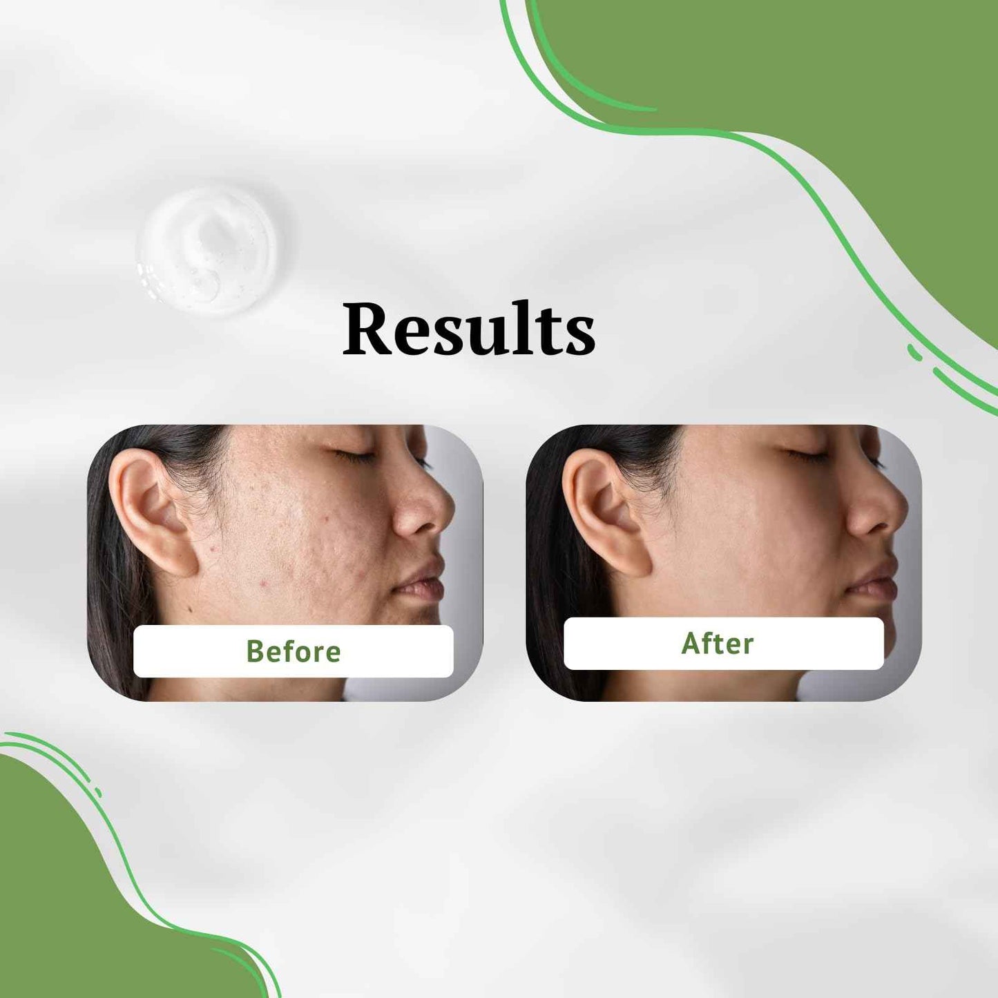 iMMense Naturals Aloe Vera Toner for Face. Skincare to Treat and Prevent Acne, Restore PH Balance & Excess Dirt. Facial Toner for Women and Men.