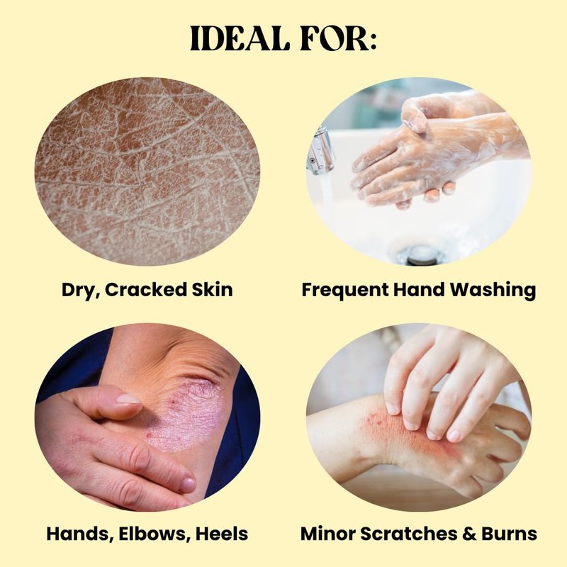 Yu-Be Yuzu Pure Hydration Cream: Body & Hand Lotion - Vegan Skin Care Cream for Sensitive & Dry Skin - Soothing Yuzu Flower Extract - Day & Night Moisturizer- Cracked Heels Repair -1.35 Fl Oz