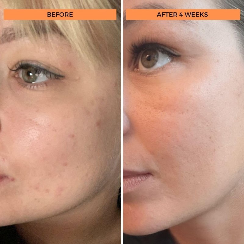 BeautyStat Universal C Serum – 20% Pure Vitamin C with Collagen-Boosting Peptides and Hyaluronic Acid to Brighten, Firm, and Strengthen Skin (15ml)