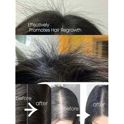 Joy Garden Herbal Scalp Tonic ? Nourishing & Oil-Free Fo-Ti and Arborvitae