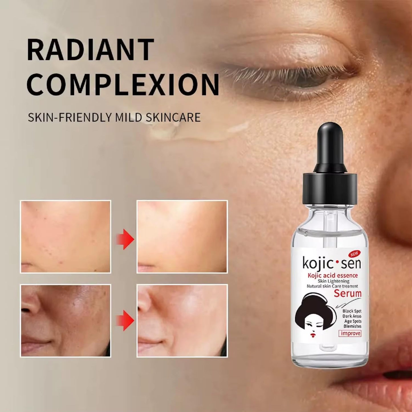 Kojic Acid Essence Serum for Radiant Complexion – Hydrating Facial Essence with Ceramide and Hyaluronic Acid – Reduces Dark Spots and Blemishes – 30ml