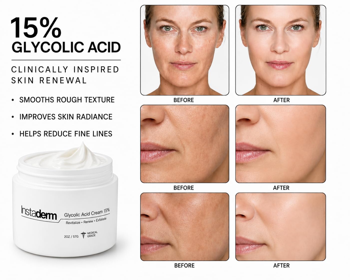 Glycolic Acid 15% Anti-Aging Wrinkle Cream- Reduces the Appearance of Fine Lines, Wrinkles, Age Spots, Dark Spots. Exfoliates, Smoothes Skin Texture, Tone & Improves Dull Looking Complexion.