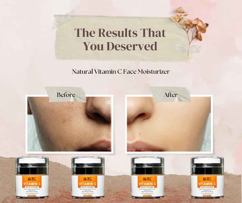 MZ Ideas Vitamin C Moisturizer face Cream - Neck and Decollete, Brighten skin - Reduces Wrinkles and fine lines, deep hydration and firming - Made in USA, 1.7 fl oz