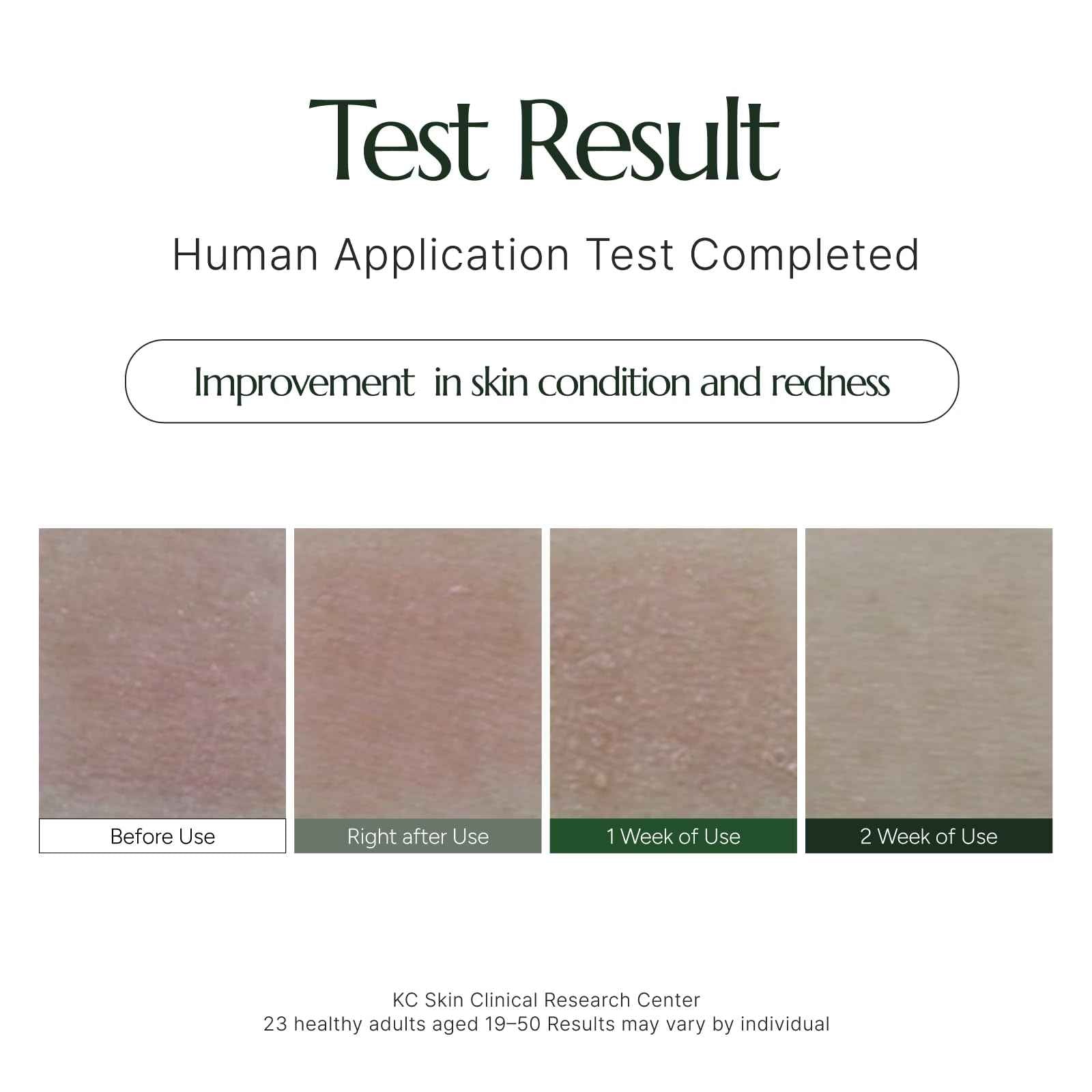 CHALLANS DE PARIS CRÈME d’AURORA EXCELLENCE – Revitalizing Moisture & Comfort Cream, Daily Comfort Formula, 2.63 fl oz (75 ml)