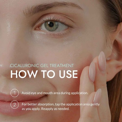 MIZON Cicaluronic GEL Treatment with Centella Asiatica Hyaluronic Acid Vitamin B5 86% Natural Ingredients Mositurizing Soothing Korean Skincare (50ml/1.69fl oz)