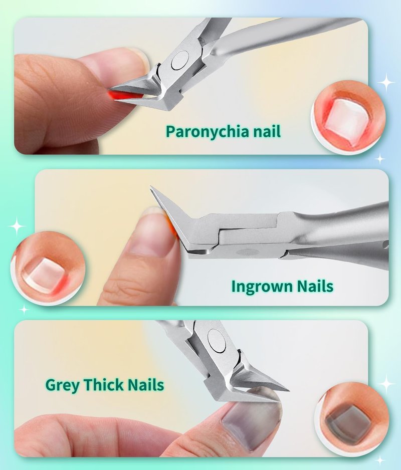 Ingrown Toenail Clippers - Sharp Pointed Stainless Steel Cutter for Thick Nails | 7-Shaped Beveled Design