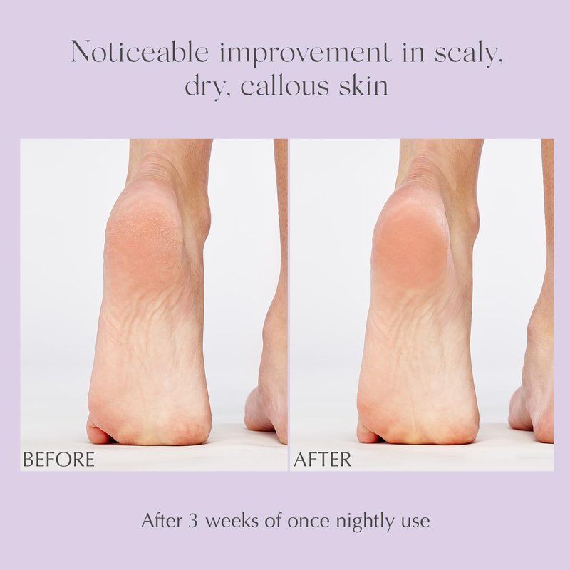 Exfoliating & Conditioning Foot Balm - Deep Moisture & Softness | 1.7 oz