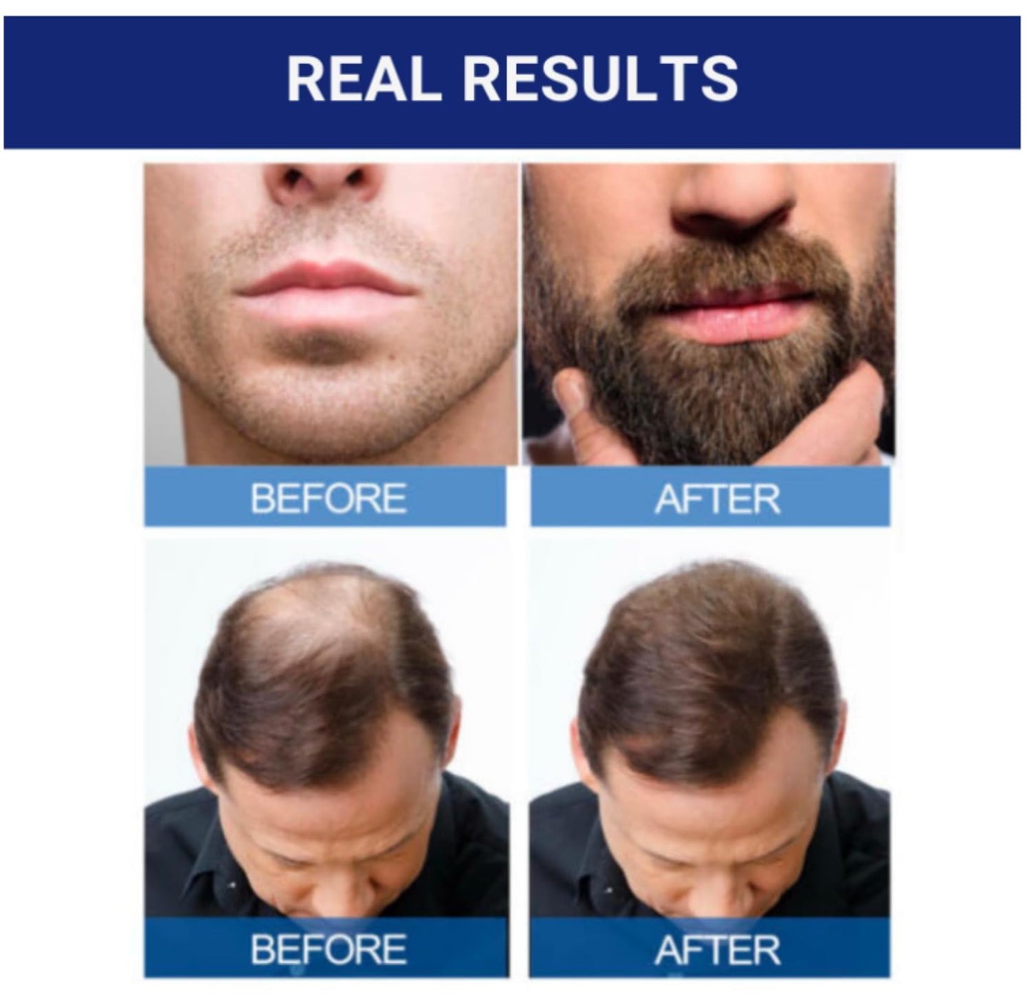 KIRKLAND SIGNATURE Minoxidil 5% Hair Regrowth Treatment for Men | 6 Months Supply | Topical Solution | Extra Strength | Clinically Proven | Unscented Drops | Dropper & Sprayer Included