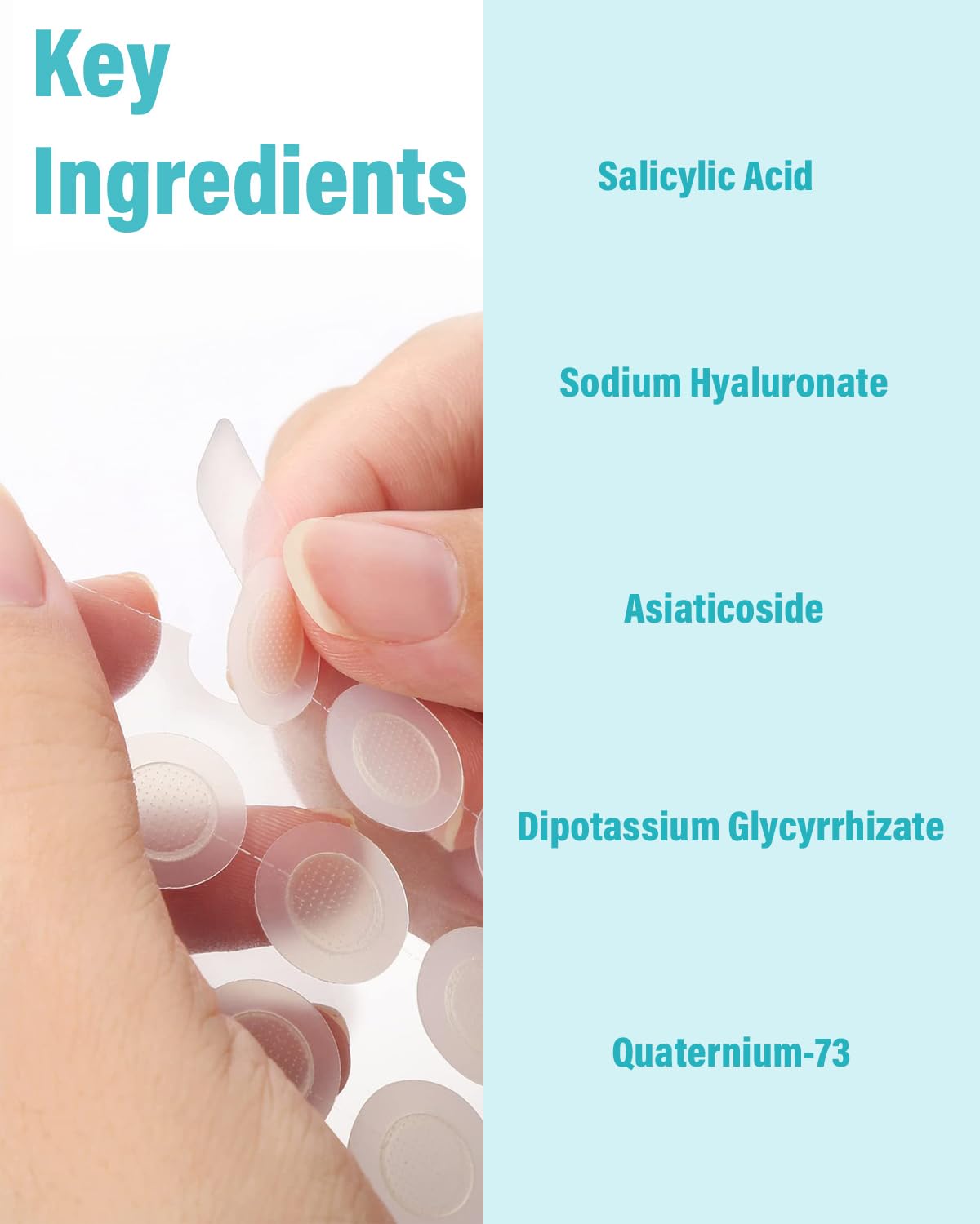Microdart Acne Patch - Hyaluronate & Salicylic Acid Hydrocolloid Treatment for Deep Blemishes | 72 Patches