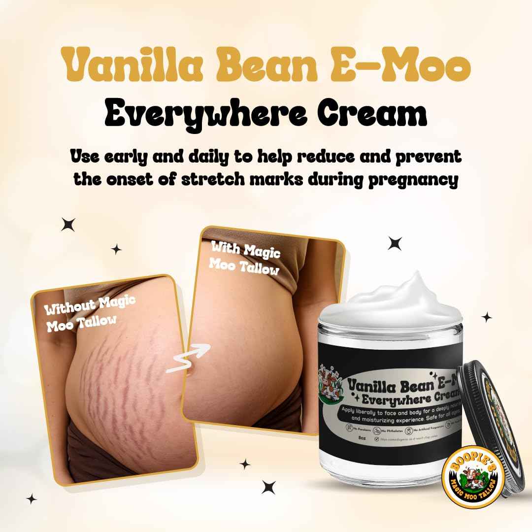 Magic Moo Tallow Vanilla Bean E-Moo Moisturizing Everywhere Cream with Organic Emu Oil. For acne, stretch marks, eczema, hyrdation, dry skin & more. 2oz