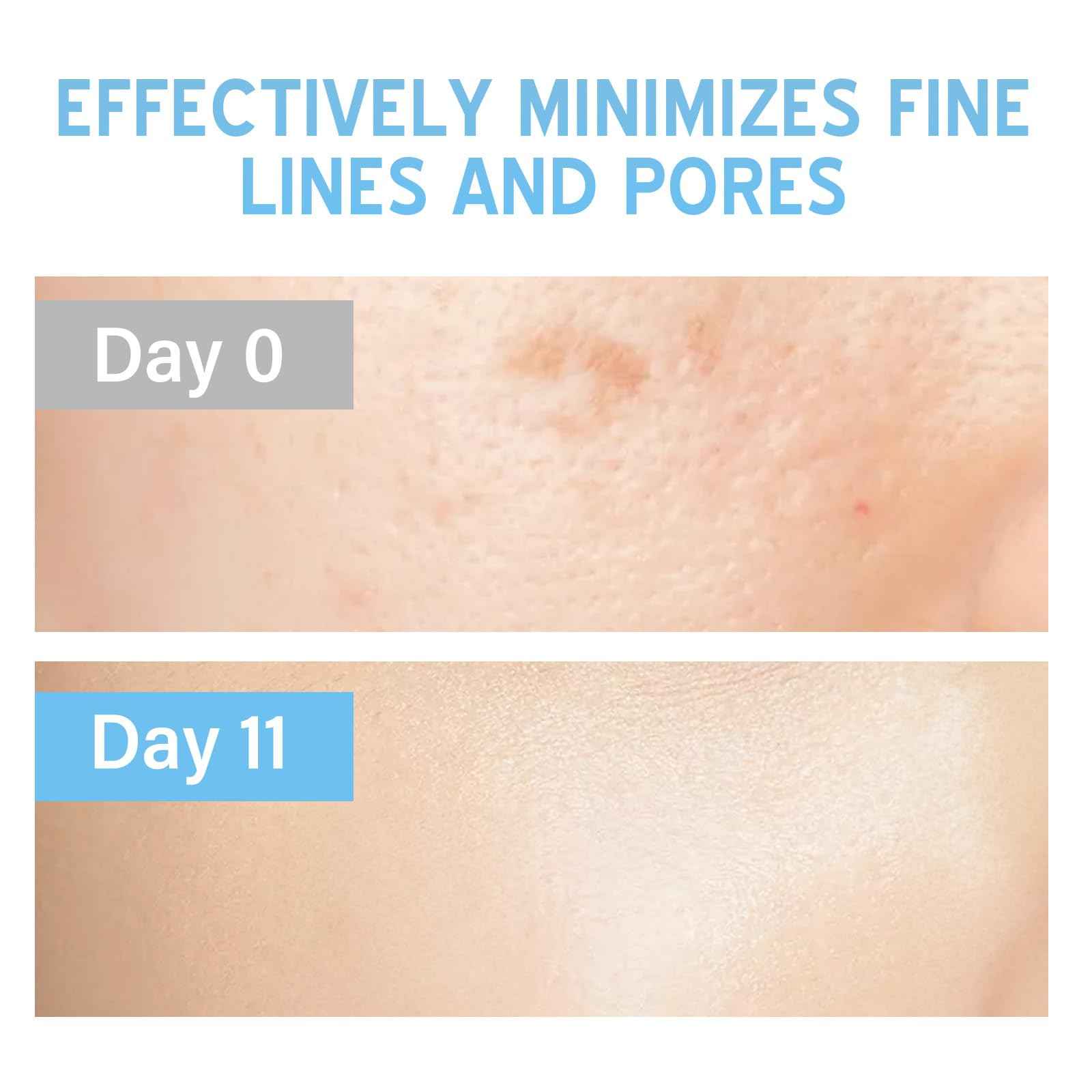 Stem Cell Serum for Face, Microneedling Serum, Anti Aging Face Essence, Makes Skin Feel Firmer, Stem Cells Strengthen and Moisturises, Use with and Without MicroNeedling