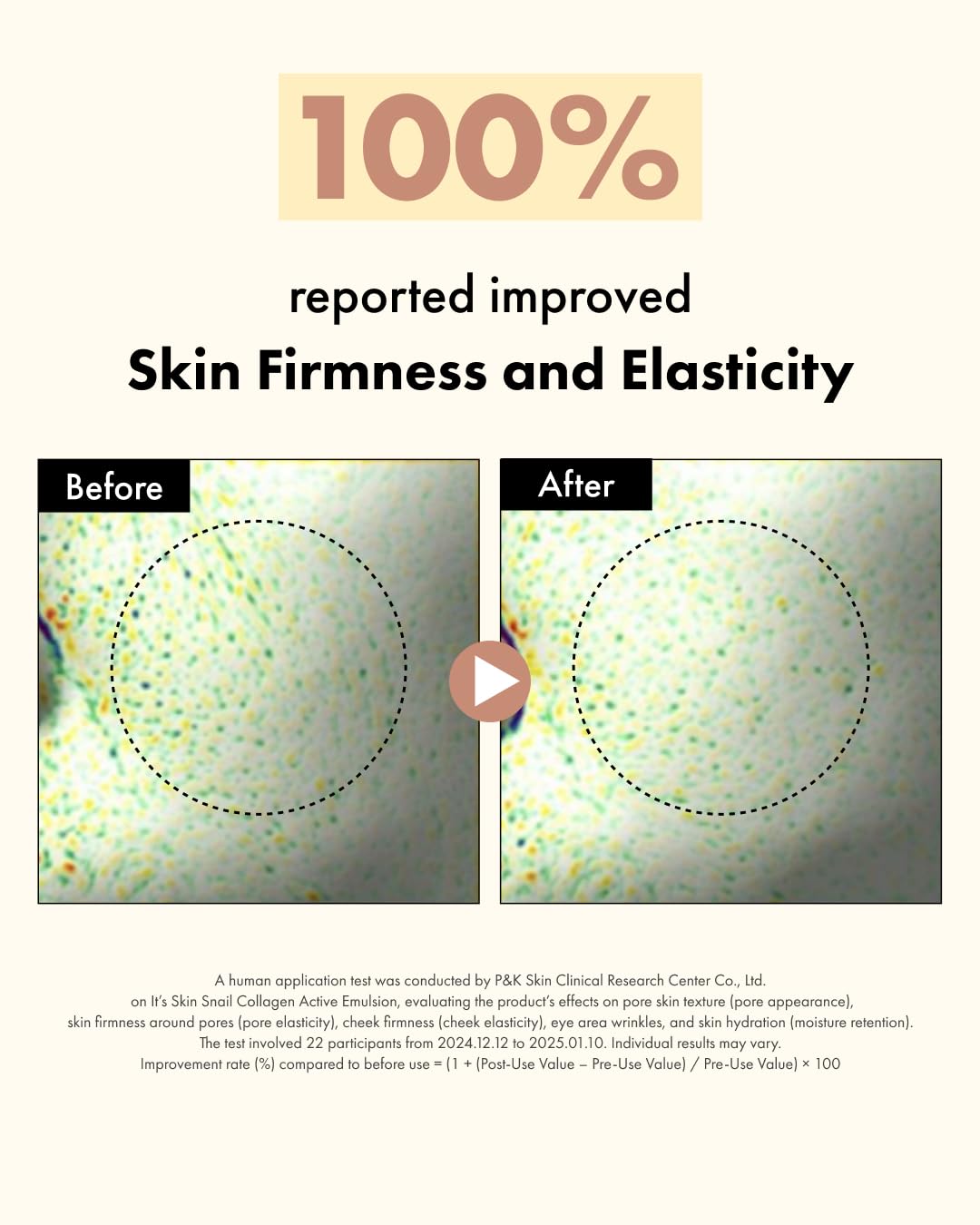 It'S SKIN Active Snail Collagen Moisturizer 4.05 fl.oz, Lightweight Liposome-Encapsulated Emulsion, Elasticity with Snail Mucin, Dual Collagen & Ceramide, Hydrating, Non-Sticky, Korean Skincare